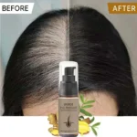 Ouhoe Hair Regrowth Treatment Spray
