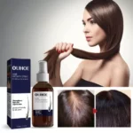 Ouhoe Hair Growth Spray