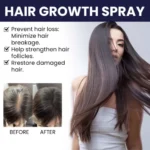 Ouhoe Hair Growth Spray