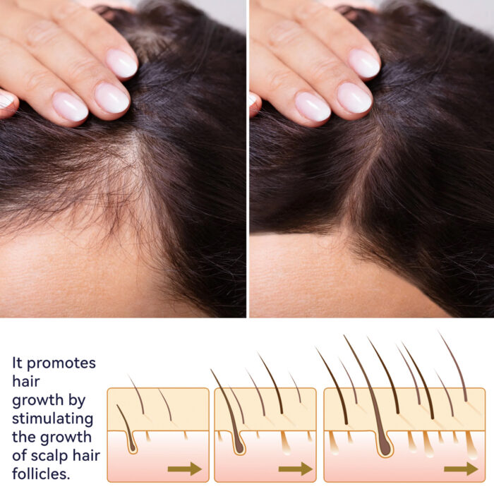 Ouhoe Hair Growth Spray