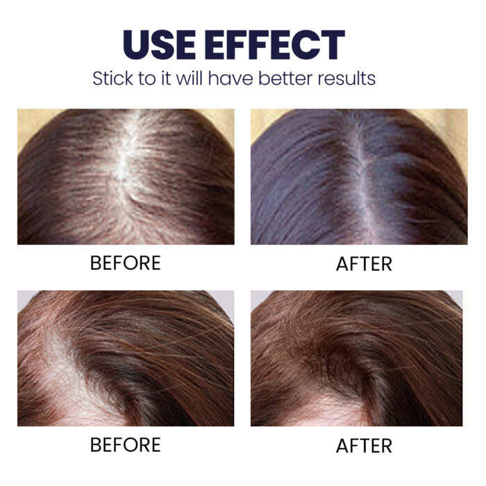 Ouhoe Hair Growth Spray