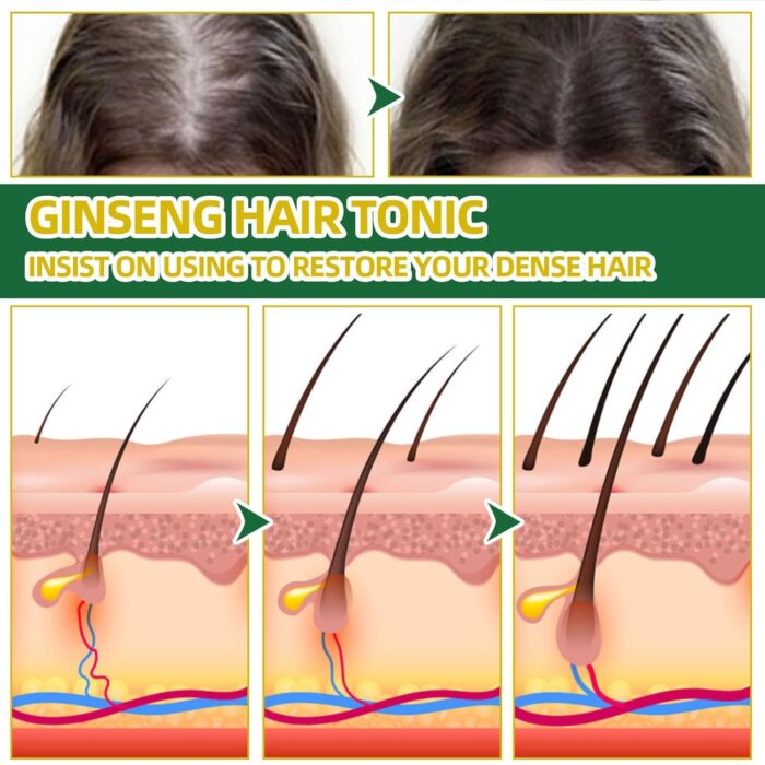 OUHOE Tonico Para Crecimiento Del Hair Growth Spray