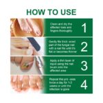 OUHOE Nail Fungal Treatment Serum