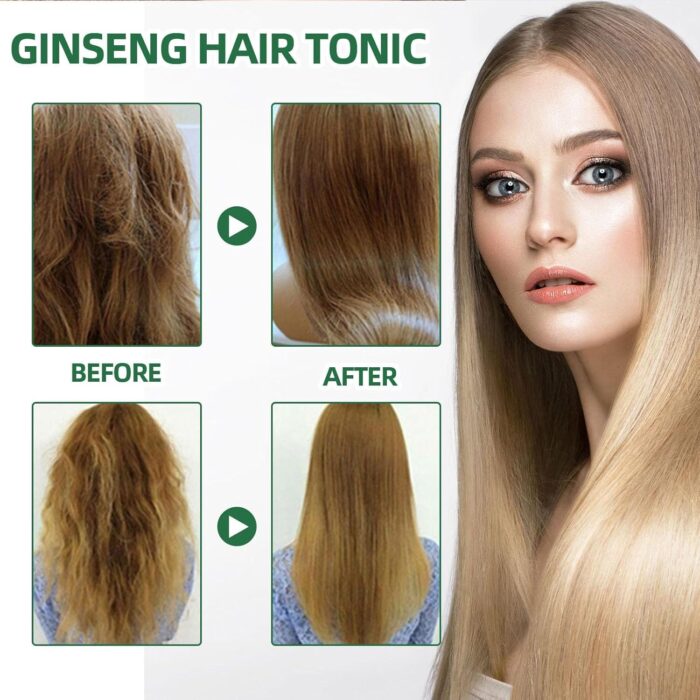 OUHOE Tonico Para Crecimiento Del Hair Growth Spray