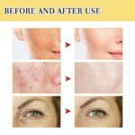 Ouhoe Snail Mucin Serum For Face