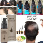 Ouhoe Hair Regrowth Treatment Spray